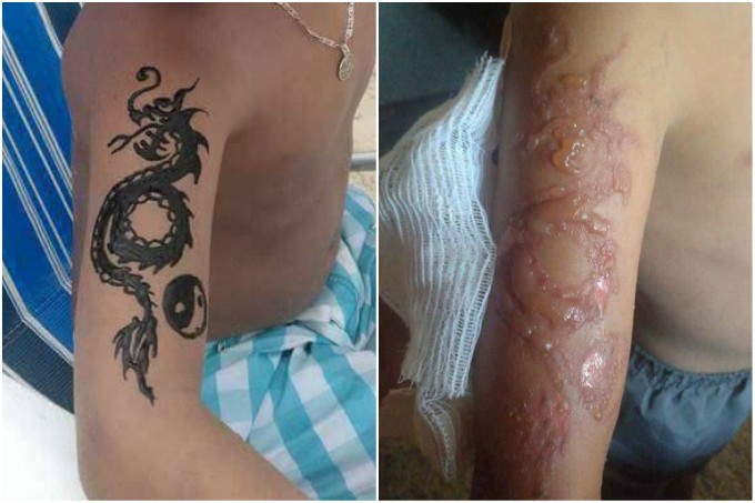 Imagenes De Tatuajes En El Pene