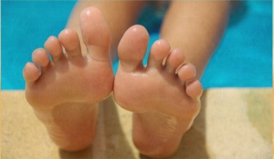 Cómo quitar los callos en los pies - 1