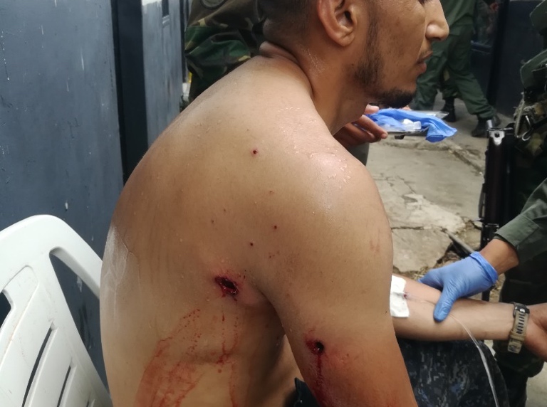 Colombia ataca a Venezuela con armas largas - 1