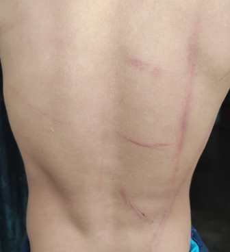 salvaje castigo a su hijo de seis años