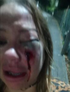 Mujer fue golpeada brutalmente