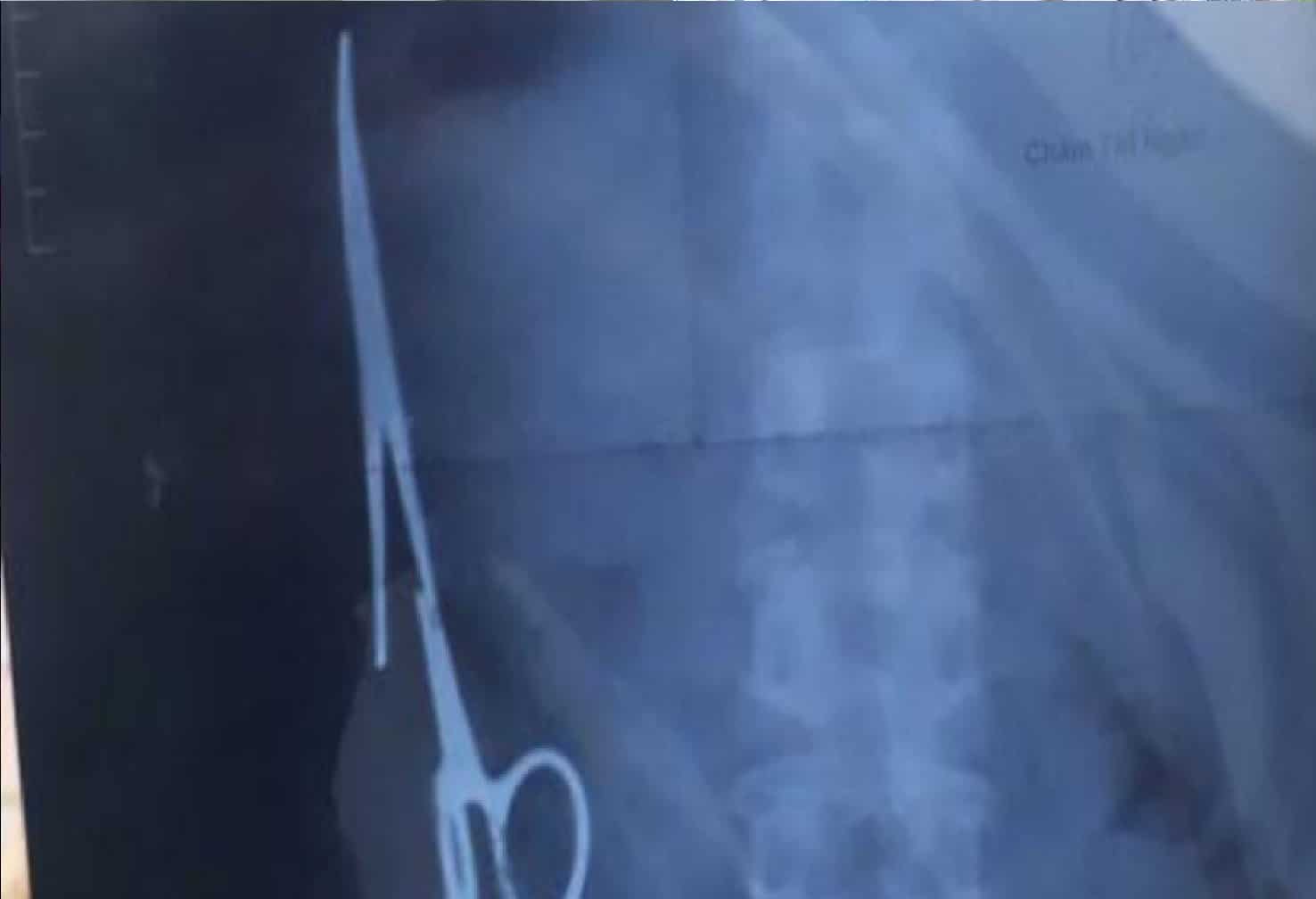 Hombre murió por una mala praxis